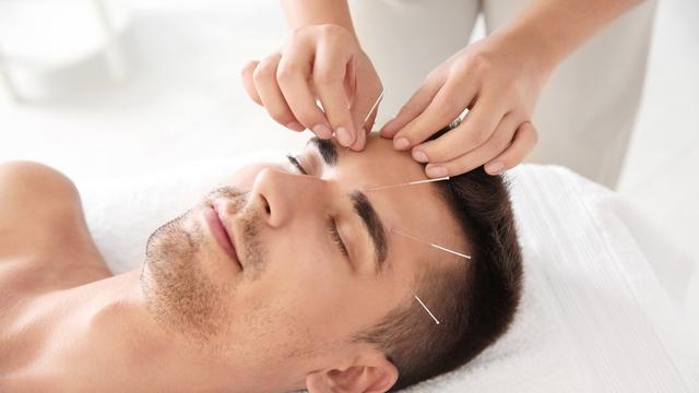 Deretan Manfaat Terapi Akupunktur Medis yang Wajib Anda 