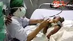 Tak hanya infotainment, MUIi juga mengharamkan transplantasi organ jika pendonor masih hidup. Namun sejumlah dokter tidak sependapat dengan fatwa itu, karena jumlah pasien yang membutuhkan pencangkokan organ sangat banyak. 