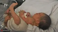 Kemungkinan Berhasil Bayi Tabung 40 Sampai 45 Persen
