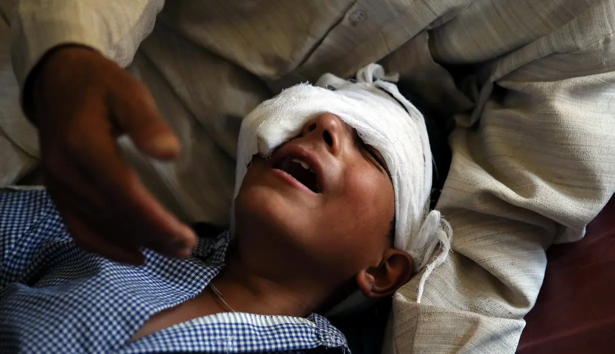 Seorang anak menangis kesakitan karena luka tembak di bagian mata akibat kerusuhan di Srinagar, Kashmir, Kamis (18/8). Sedikitnya lima orang tewas dan 20 lainnya mengalami luka parah akibat bentrok antara warga dan petugas keamanan. (REUTERS)