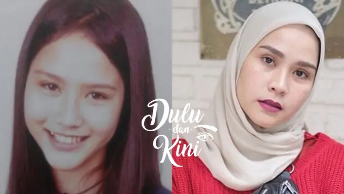 Dulu dan Kini: Transformasi Zaskia Adya Mecca dari Cupu Hingga Menawan