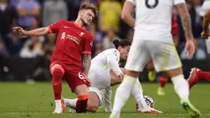 Bintang muda Liverpool, Harvey Elliott, mengalami cedera parah saat timnya bersua Leeds United pada laga pekan keempat Premier League, Minggu (12/09/2021). (Foto:AFP/Oli Scarff)