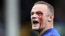 Striker Everton, Wayne Rooney, mengalami pendarahan di mata kirinya usai duel udara dengan bek Bournemouth, Simon Francis, pada Premier League, di Stadion Goodison Park, Sabtu (23/9/2017). Everton menang 2-1 atas Bournemouth. (AP/Barrington Coombs)