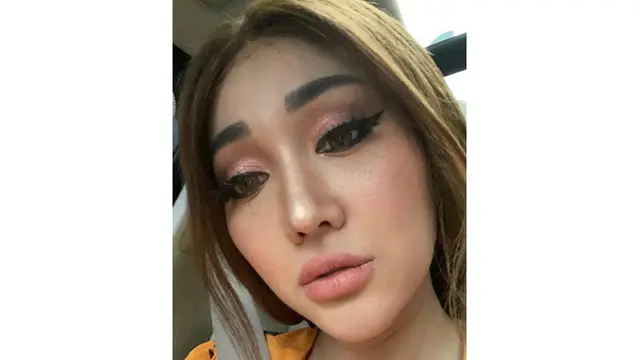 Perawatan Habis Rp 1,5 Miliar, Ini 6 Potret Terbaru Lucinta Luna Makin Menawan
