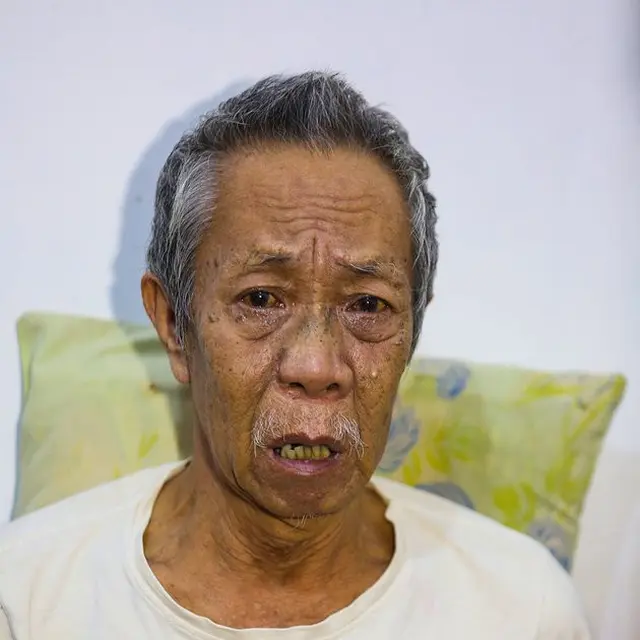 6 Potret Terbaru Pak Ogah Si Unyil, Idap Penyakit Penyumbatan Pembuluh Darah Otak