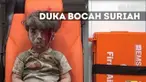 Dunia berduka, setelah beredar video Omran Daqneesh, 5 tahun, korban serangan udara di Aleppo, Suriah. Tubuhnya diselimuti debu dengan luka di dahi saat Ia diselamatkan dari reruntuhan bangunan. 