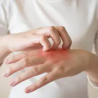 Ilustrasi Telapak Tangan/https://www.shutterstock.com/Orawan Pattarawimonchai