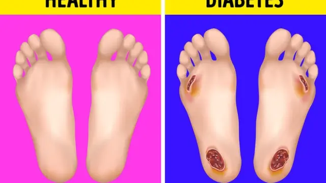 tanda di kaki ini bisa ungkap kondisi kesehatan (Brightside)
