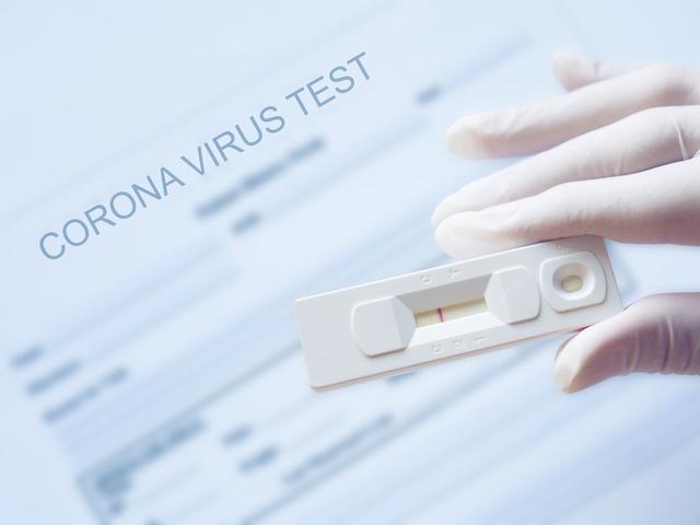 5 Tanggapan Usai Kasus Alat Rapid Test Daur Ulang Di Bandara Kualanamu News Liputan6 Com