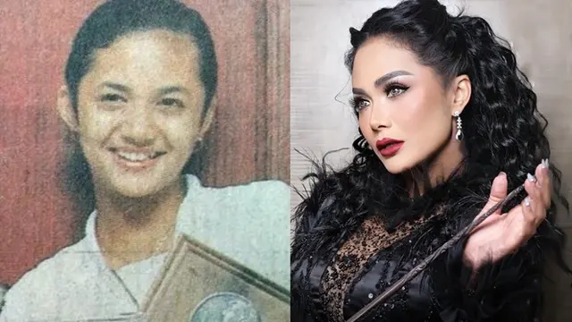 Beda Penampilan 9 Artis Sebelum vs Setelah Operasi Plastik, Bikin Pangling