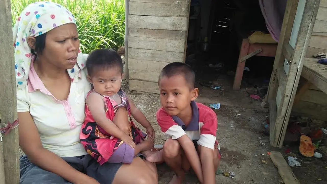 Bayi Makan Ular