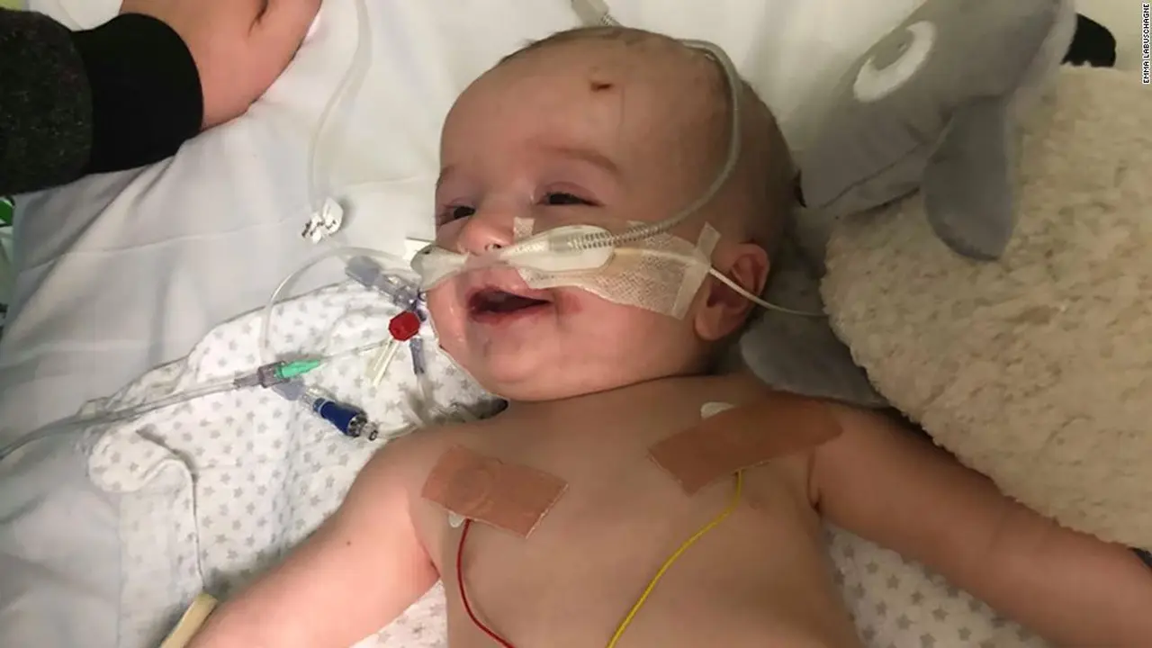 Michael, bayi penderita tumor langka.