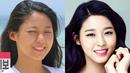 Wajah Seolhyun AOA menjadi penuh jerawatan karena kerapa mengenakan makeup. (Foto: koreaboo.com)
