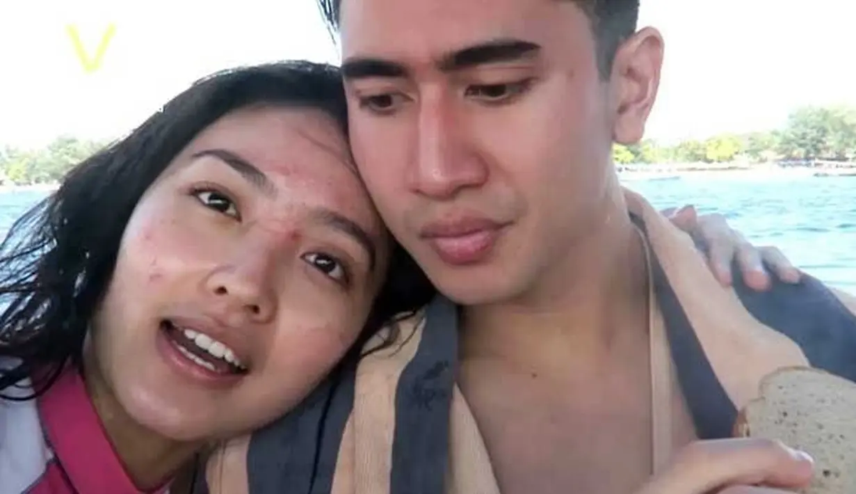 Natasha Wilona ketika berjerawat (YouTube/Verrel Bramasta)