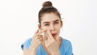 How to Get Rid of Blackheads and How to Prevent It