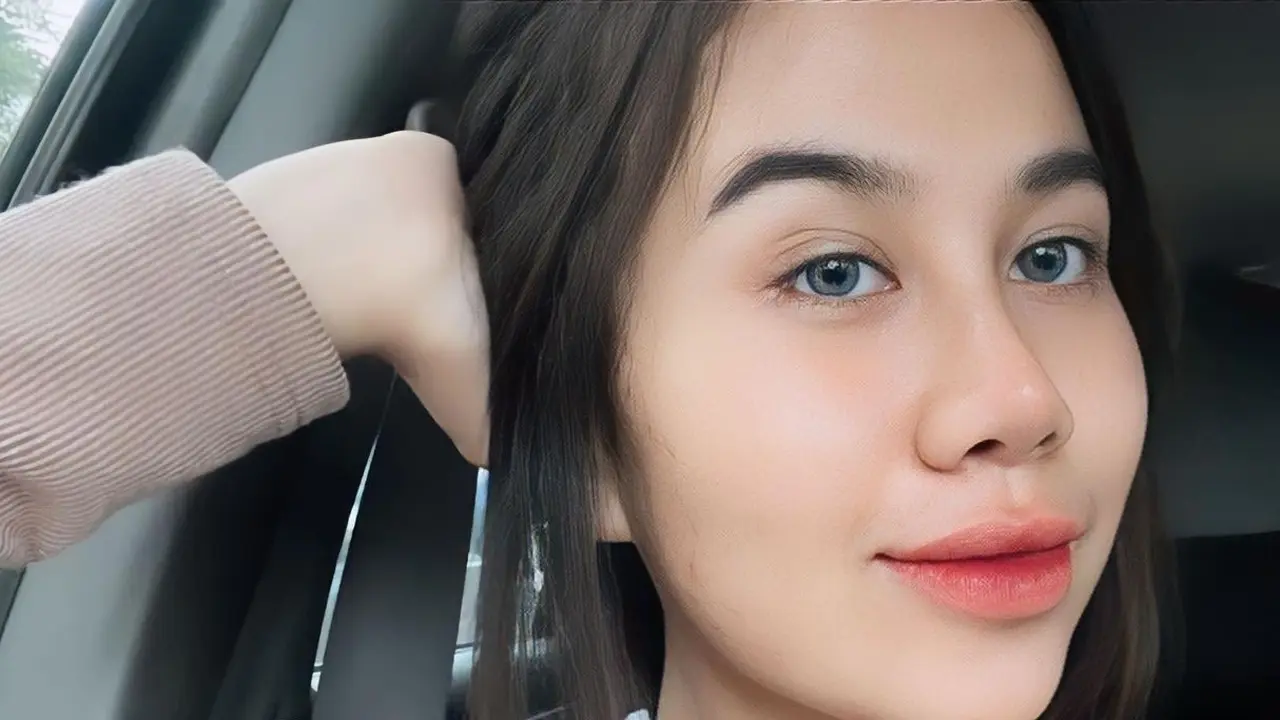 8 Potret Perubahan Wajah Mayang Usai Operasi Hidung, Sudah Lepas Perban