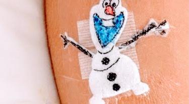 Kreatif Dokter Bedah Bikin Karakter Kartun Di Bekas Luka Pasien Citizen6 Liputan6 Com