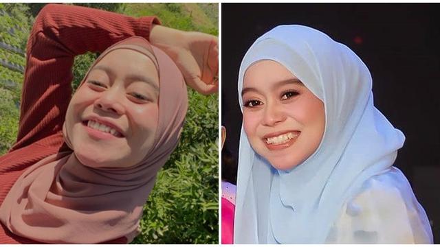 6 Beda Gaya Lesti Kejora Sebelum vs Sesudah Pakai Behel, Hilangkan Gingsul