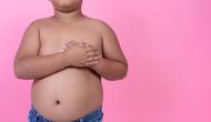 Obesitas pada Anak Bisa Picu Gangguan Kesehatan Mental, Begini Penjelasan Dokter. Foto: Freepik.