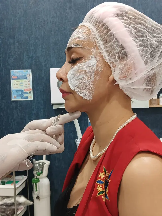 Gusto Rosaline Oca saat menjalani treatment tanam benang