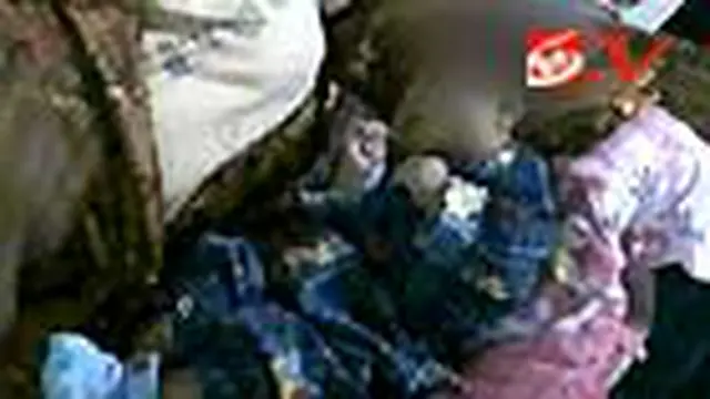 Bayi Tanpa Tempurung Kepala Menanti Dermawan