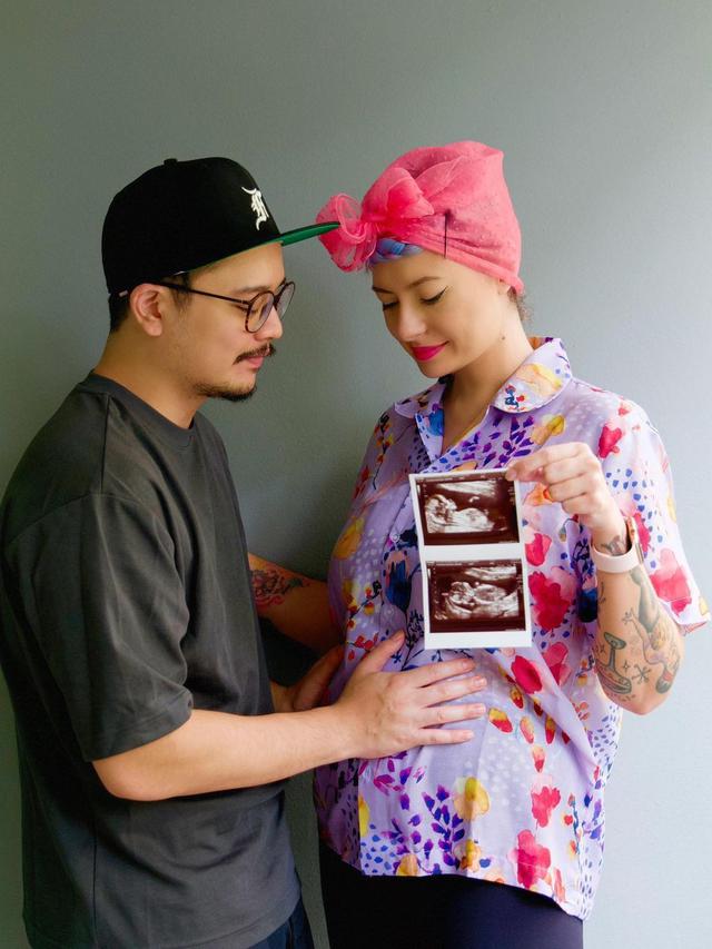 6 Potret Derby Romero Jadi Suami Siaga, Siap Sambut Kelahiran Anak Perempuan