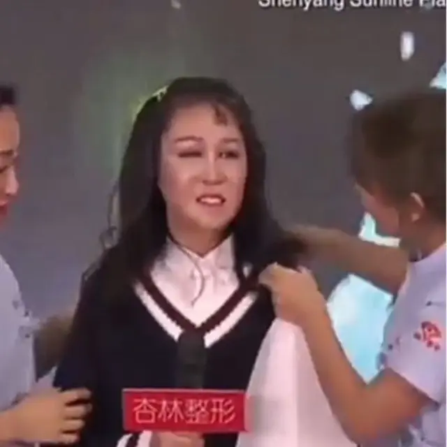 Gadis China Menjalani Operasi Plastik Karena Penyakit Langka