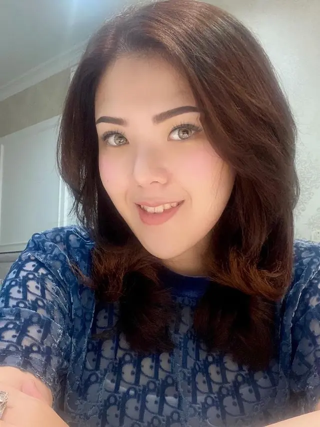 8 Potret Penampilan Baru Tina Toon dengan Wajah Tirus, Bikin Pangling