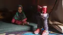 Bocah Suriah, Maya Merhi berpose dekat kaki prostetiknya yang dihiasi bendera Turki di kamp Serjilla, 9 Desember 2018. Sebelumnya, gadis 8 tahun yang lahir tanpa kaki karena kondisi bawaan terpaksa menggunakan kaki palsu dari kaleng. (Aaref WATAD/AFP)