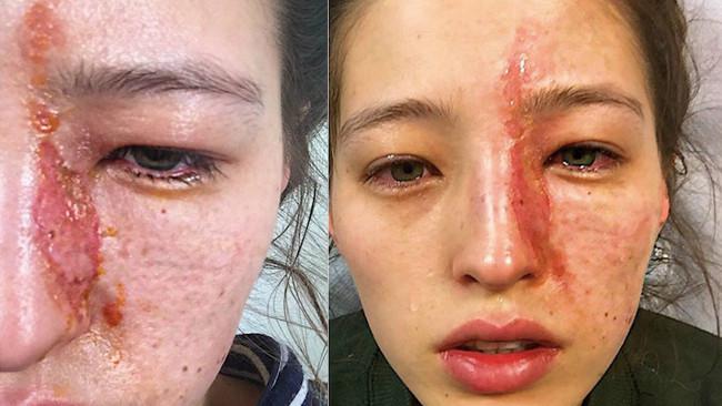 Emily Smith (worldofbuzz.com)