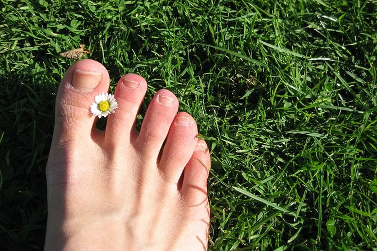 Kuku Kaki Menguning? Ini 5 Penyebabnya (Gambar oleh Hans Braxmeier dari Pixabay)