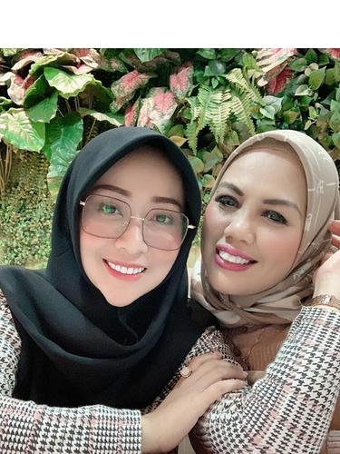 6 Potret Terbaru Ely Sugigi Setelah Lakukan Potong Gigi, Banjir Pujian