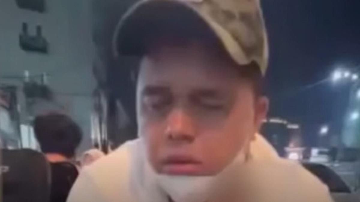 Video Hisap Vape Narkoba Sampai Teler Viral di Medsos, Kompol DK Dipatsus