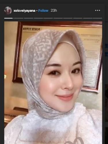 Ayana Jihye Moon (Foto: Instagram/@xolovelyayana)