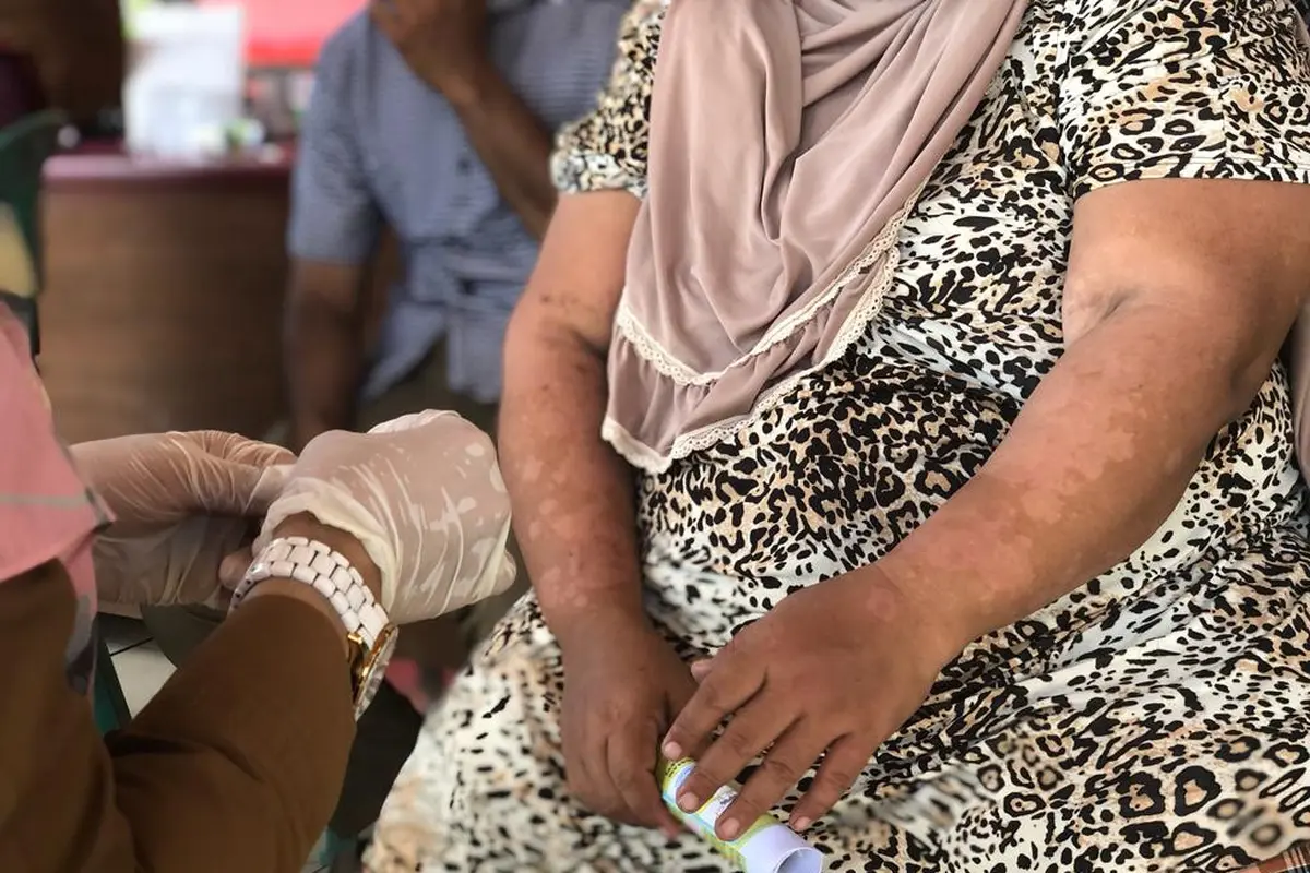 Penanganan kusta di Indramayu