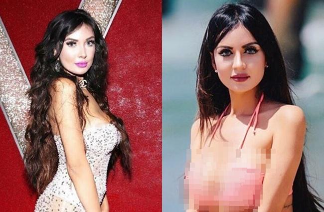 Jennifer melakukan berbagai prosedur operasi plastik agar mirip barbie | Photo: Copyright thesun.co.uk