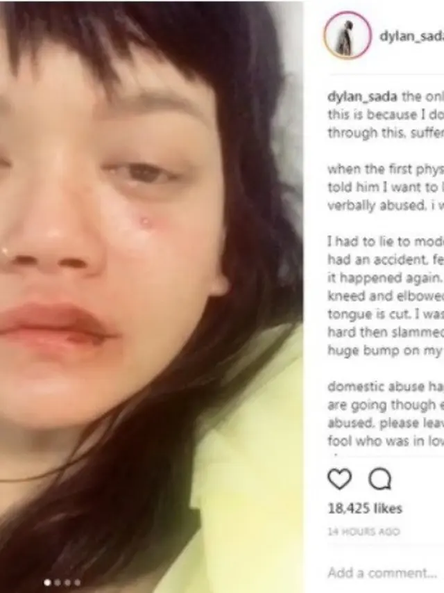 Dylan Sada mengalami kekerasan dalam hubungannya ©instagram/dylan_sada