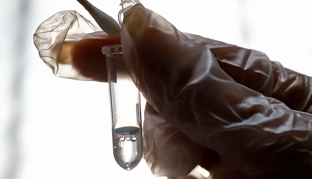 Petugas medis menguji sampel dari pasien yang diduga terinfeksi virus corona atau COVID-19 di sebuah rumah sakit di Teheran, Iran, Minggu (1/3/2020). Kasus virus corona di Iran mengalami lonjakan tajam dalam beberapa hari. (Ali Shirband/Mizan News Agency via AP)