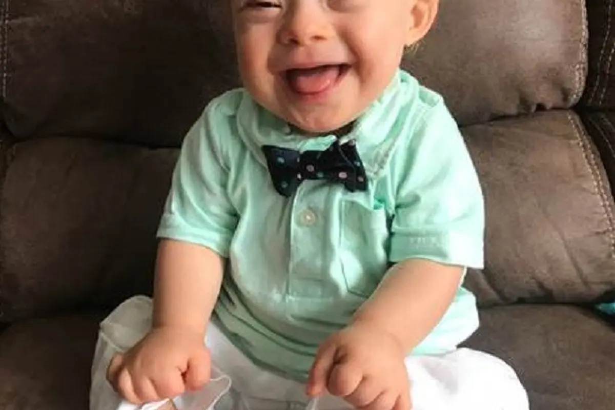 Down Syndrome
