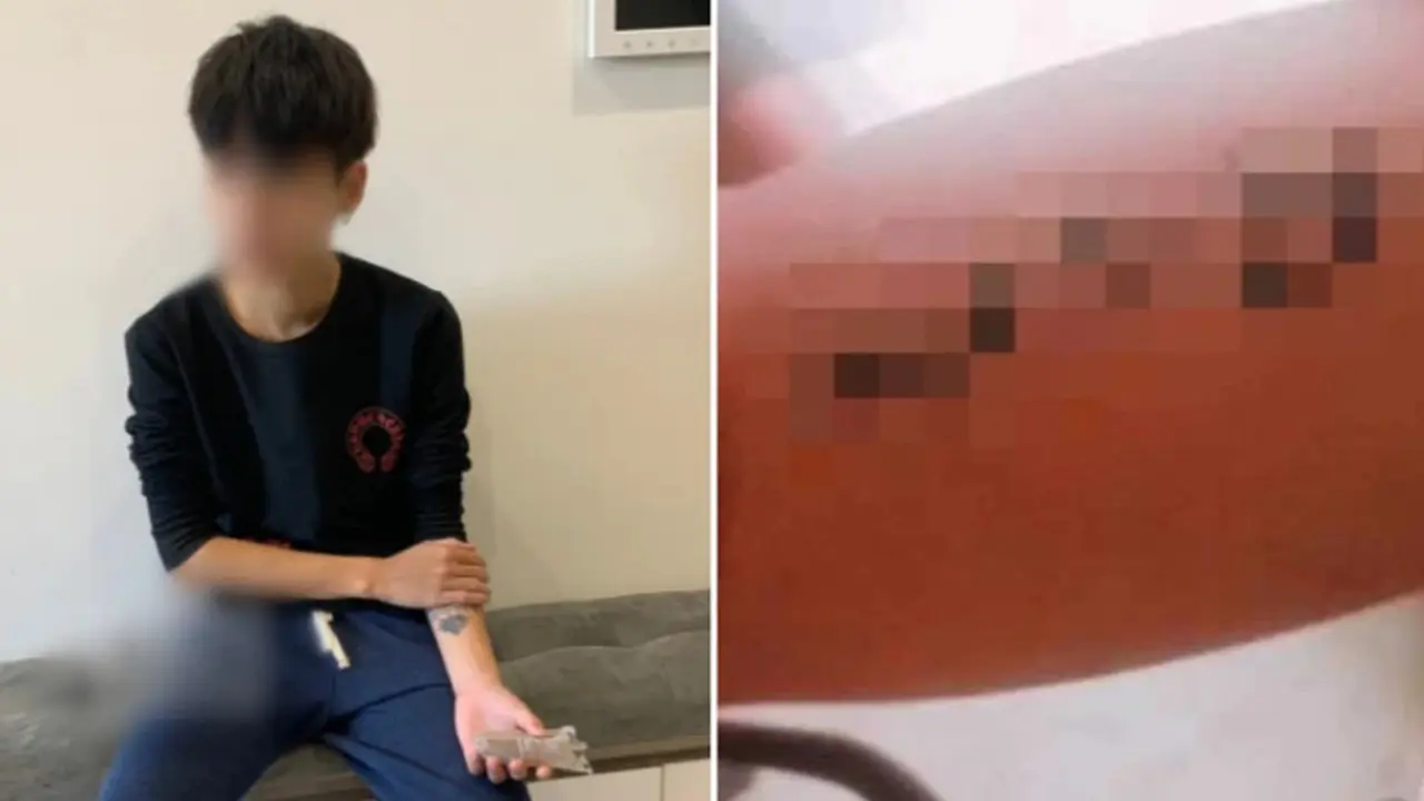Bikin Tato Nama Pacar, Pria Ini Justru Diputuskan Seminggu Kemudian