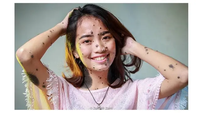 standar kecantikan