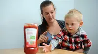 Bocah Ini Bisa Meninggal Jika Makan Saus Tomat