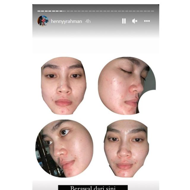 Henny Rahman Hamil dan Akui Wajahnya Berubah, Ini 6 Potret Terbarunya