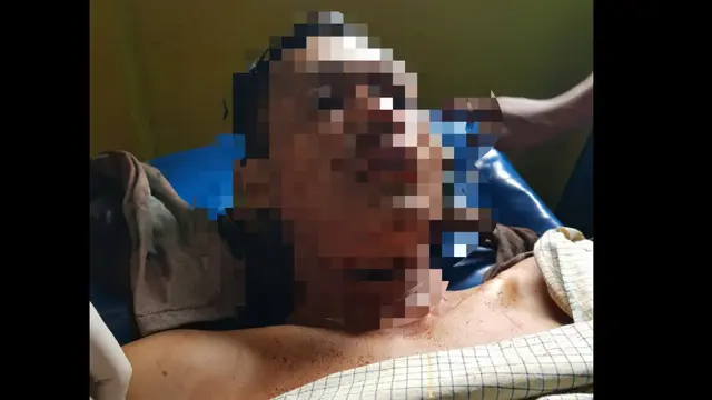 Darmawan saat mendapat pertolongan pertama di Puskesmas (Fauzan/Liputan6.com)