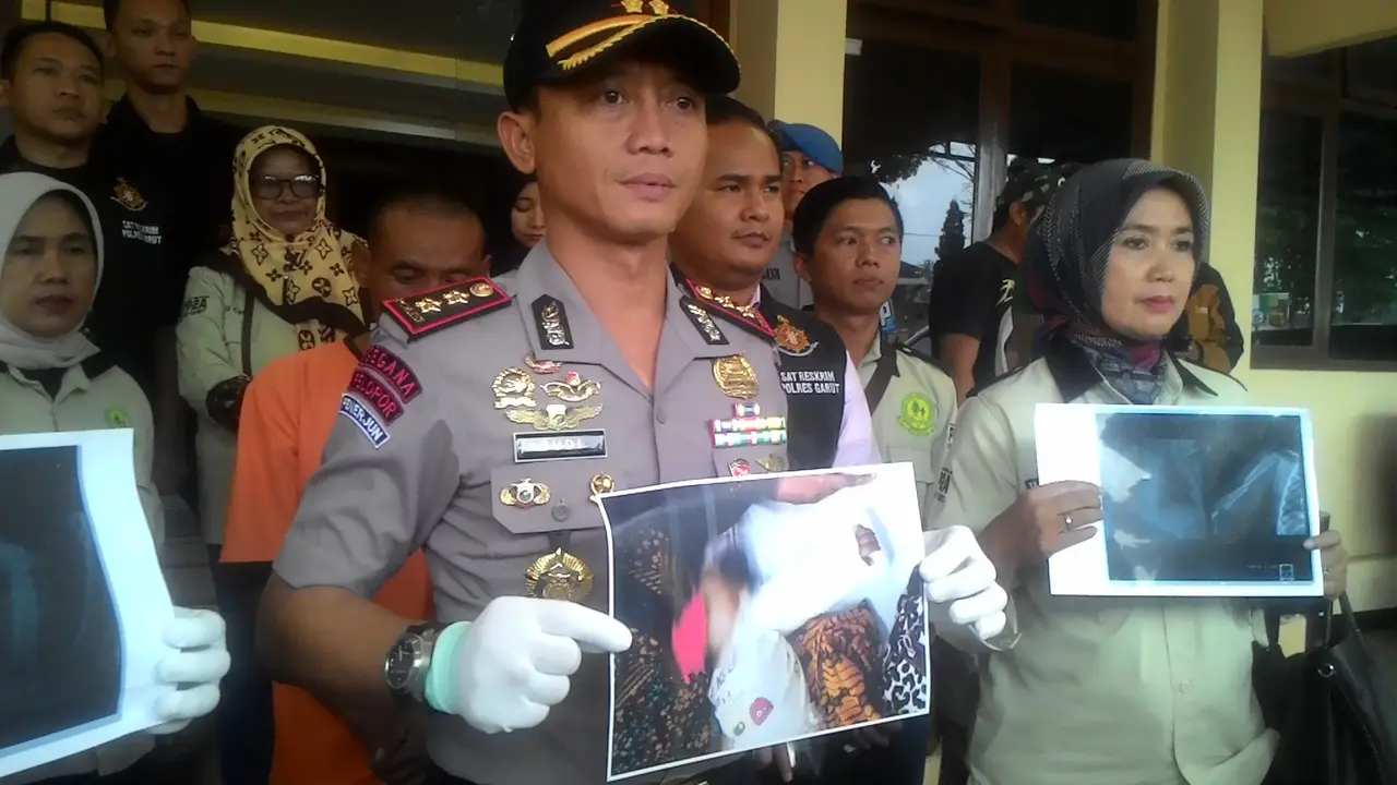 Kapolres Garut AKBP Budi Satria Wiguna menunjukan sejumlah hasil rontgen patahan tulang tangan bayi korban kekerasan di Garut
