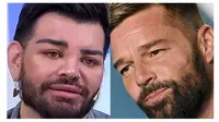 Ingin Mirip Ricky Martin, Pria Ini Lakukan Operasi Plastik hingga 40 Kali (Sumber: Oddity Central)