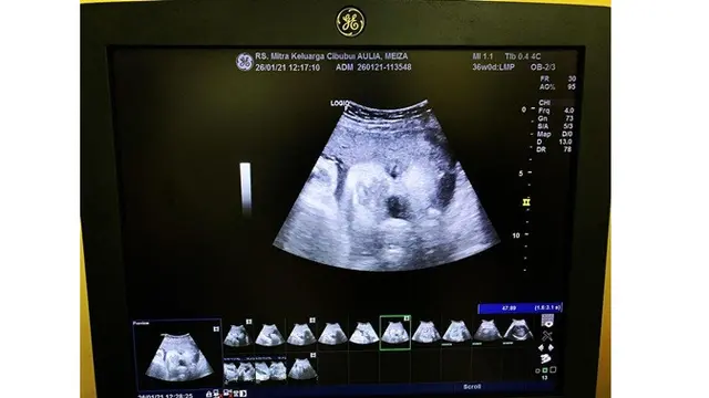 Eza Gionino dan Istri Dikaruniai Anak Kedua, Ini 7 Potret Perjalanan Kehamilannya
