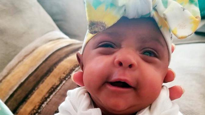 Foto pada 28 Mei 2019 memperlihatkan seorang bayi yang dipanggil dengan nama Saybie. Menurut Tiniest Babies Registry,  Saybie diyakini memecahkan rekor bayi terkecil di dunia yang sebelumnya dipegang seorang bayi yang lahir dengan berat badan 8,9 ons pada 2015 di Jerman. (Sharp HealthCare via AP)