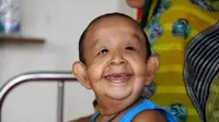 Kisah Bocah 4 Tahun yang 'Terperangkap' dalam Tubuh Kakek-kakek