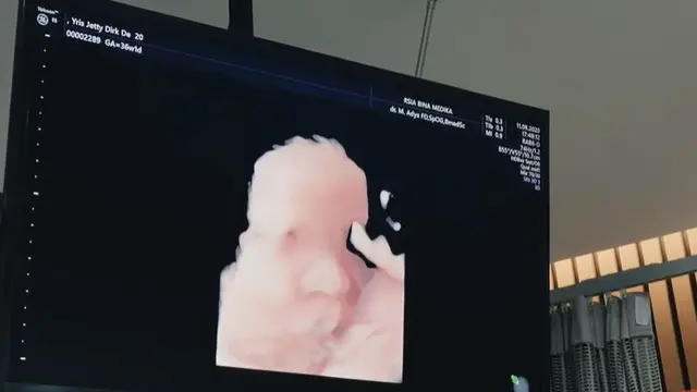 Waktu Persalinan Dipercepat, Ini 6 Potret Persiapan Irish Bella dan Ammar Zoni